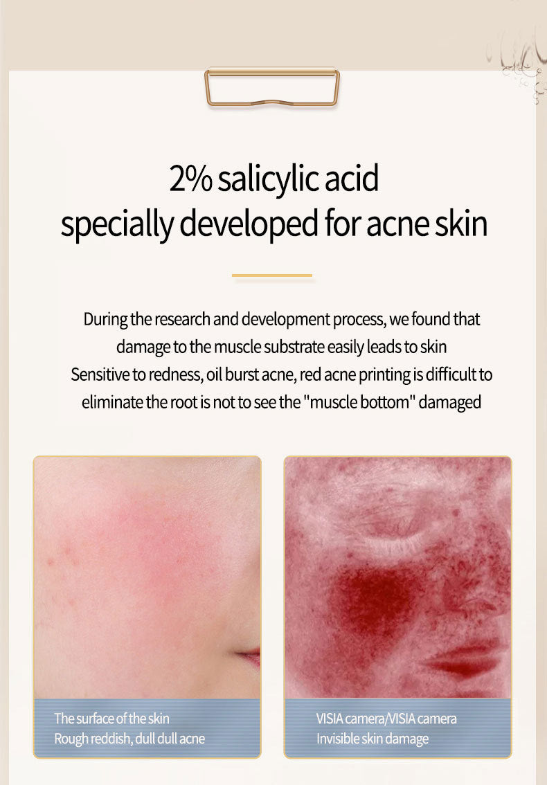 Salicylate Skincare Solution – Pore Cleansing Topical Product